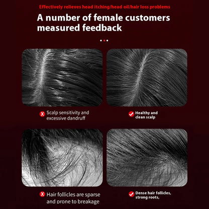 VITALBEAM FOLLICLE ACTIVATOR